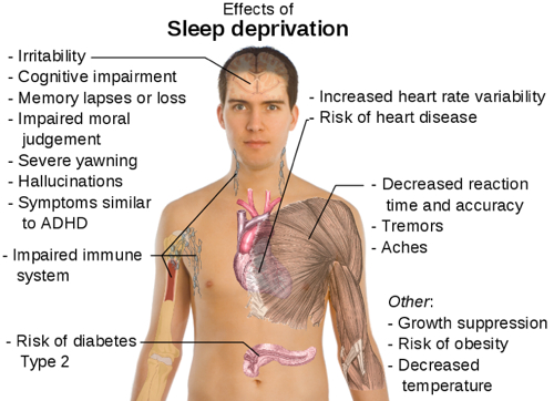 effects of sleep deprivation